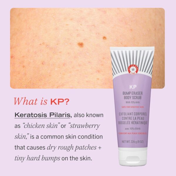 First Aid Beauty KP Bump Eraser Body Scrub Exfoliant for Keratosis Pilaris with 10% AHA – 8 oz - Image 3